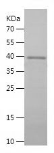    USP9X / Recombinant Human USP9X