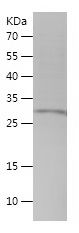    TMEM35A / Recombinant Human TMEM35A