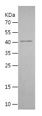    TIMP4 / Recombinant Human TIMP4