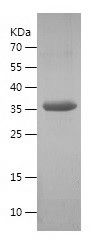    GNMT / Recombinant Human GNMT