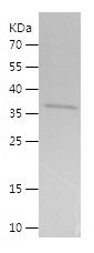    CALB1 / Recombinant Human CALB1
