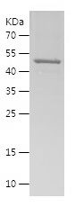    PSPH / Recombinant Human PSPH