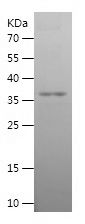    TOP2B / Recombinant Human TOP2B