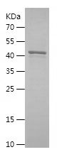    PLK4 / Recombinant Human PLK4