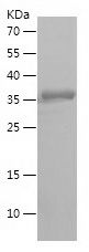    H2AX / Recombinant Human H2AX