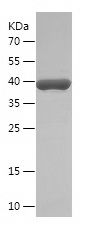    MPP8 / Recombinant Human MPP8