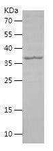    SPHK2 / Recombinant Human SPHK2