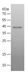    DNAJB11 / Recombinant Human DNAJB11