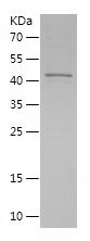    NAT10 / Recombinant Human NAT10