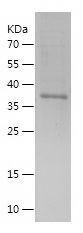    DDX1 / Recombinant Human DDX1