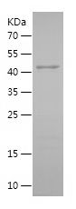    MED15 / Recombinant Human MED15