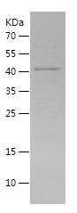    SIRT6 / Recombinant Human SIRT6