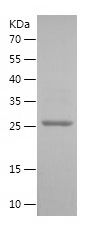    HPRT1 / Recombinant Human HPRT1