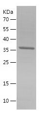    METTL14 / Recombinant Human METTL14