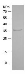    SLC7A1 / Recombinant Human SLC7A1