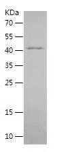    FASTKD2 / Recombinant Human FASTKD2