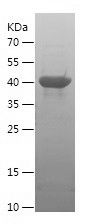    MPP5 / Recombinant Human MPP5