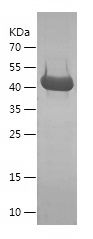    CYB5R3 / Recombinant Human CYB5R3