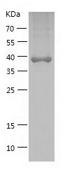    AGGF1 / Recombinant Human AGGF1