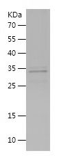    RAB8A / Recombinant Human RAB8A