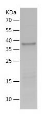    SGTA / Recombinant Human SGTA