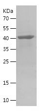    SDHA / Recombinant Human SDHA