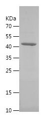    MYH11 / Recombinant Human MYH11