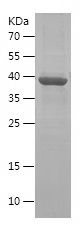    DKK3 / Recombinant Human DKK3