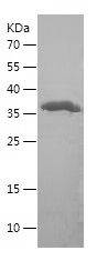    TGFBI / Recombinant Human TGFBI