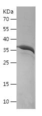    ISCU / Recombinant Human ISCU