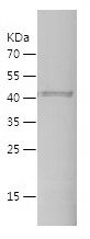    CD335 / Recombinant Human CD335