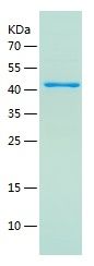    MYH6 / Recombinant Human MYH6