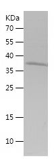    SLC16A1 / Recombinant Human SLC16A1