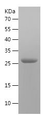    RAB5A / Recombinant Human RAB5A