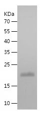    SDC4 / Recombinant Human SDC4