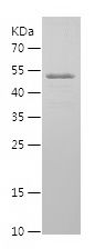    SOD3 / Recombinant Human SOD3