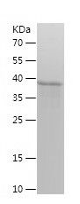    WAS / Recombinant Human WAS