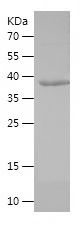    EIF2AK3 / Recombinant Human EIF2AK3