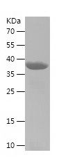    NEDD4 / Recombinant Human NEDD4