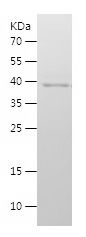    CENPJ / Recombinant Human CENPJ