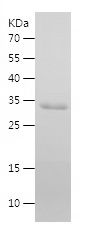    PRAME / Recombinant Human PRAME