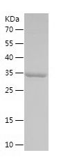 Recombinant Mouse IGF-1