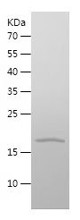    RBP7 / Recombinant Human RBP7