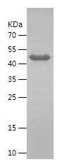    SKAP2 / Recombinant Human SKAP2