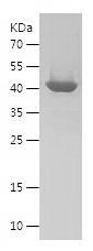    SPOP / Recombinant Human SPOP