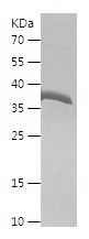    ALDOB / Recombinant Human ALDOB