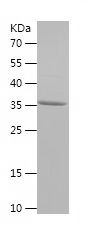    ALDH1A1 / Recombinant Human ALDH1A1