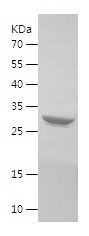    VAPB / Recombinant Human VAPB