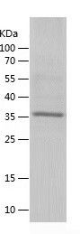    NQO1 / Recombinant Human NQO1