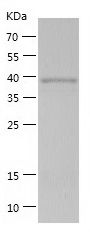    NEDD4L / Recombinant Human NEDD4L